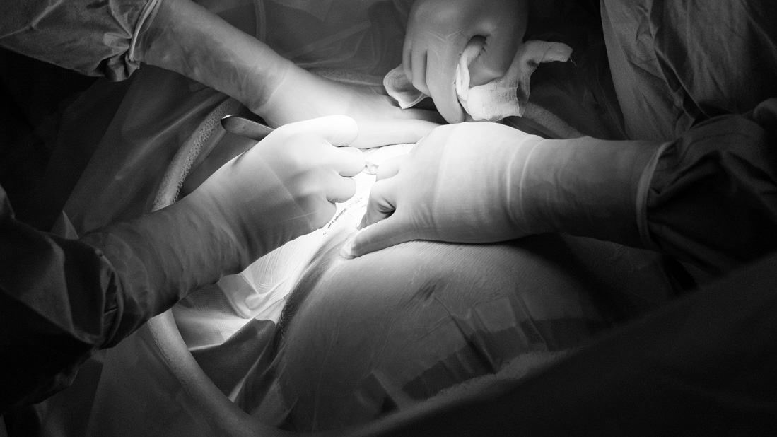 Doctors doing surgery