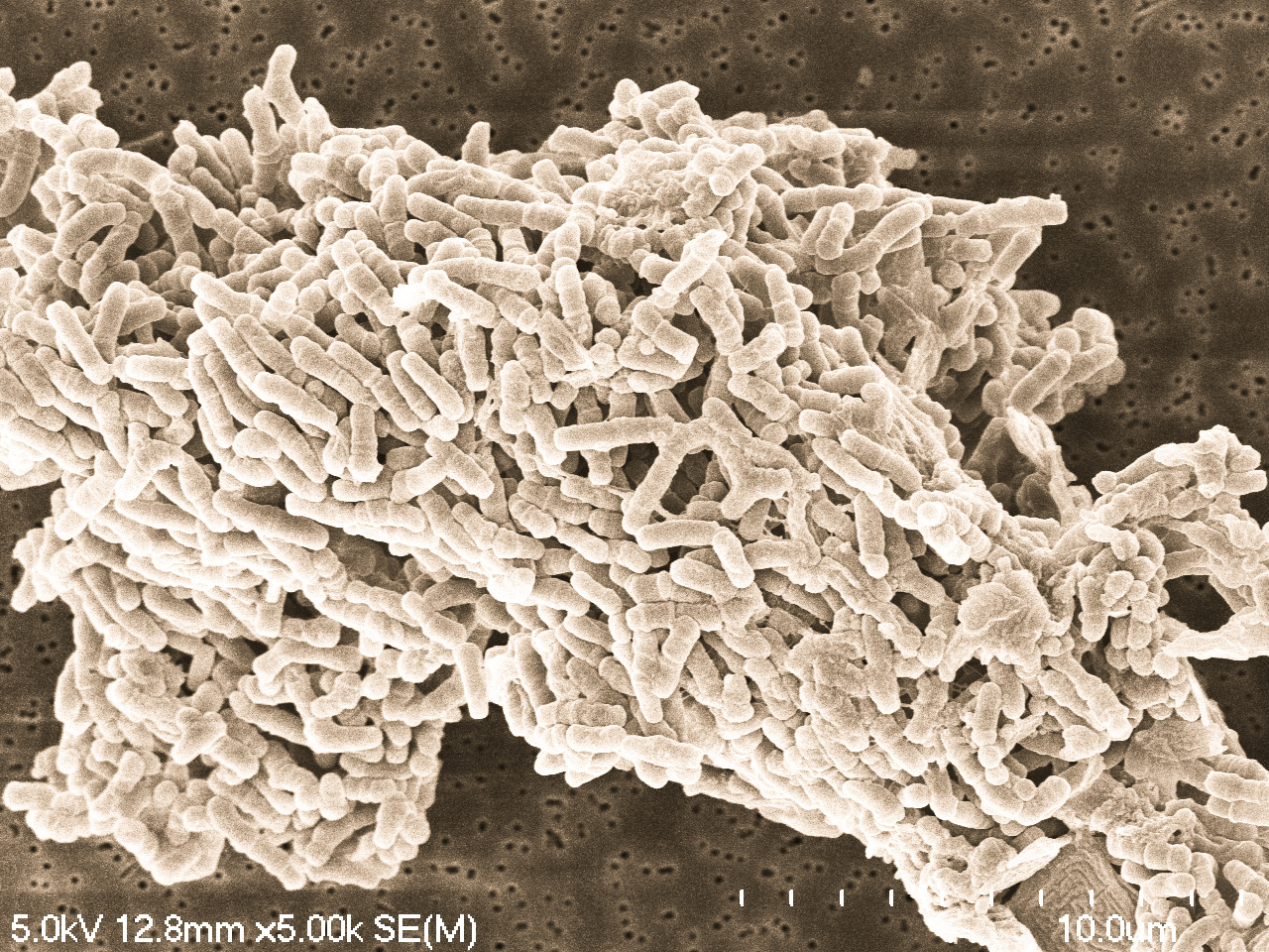 B. infantis EVC001 Sepia