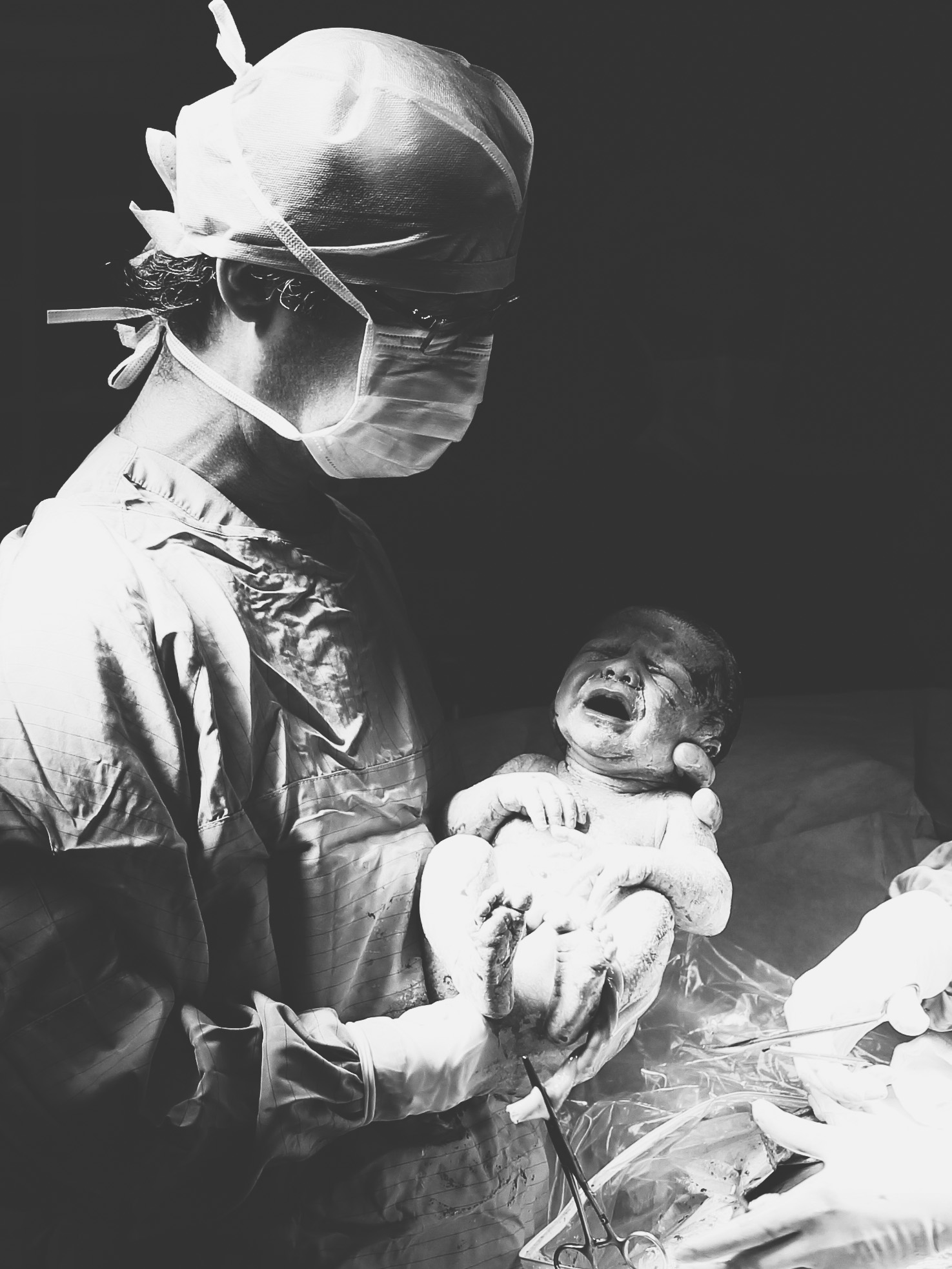 Cesarean delivery in the operating room